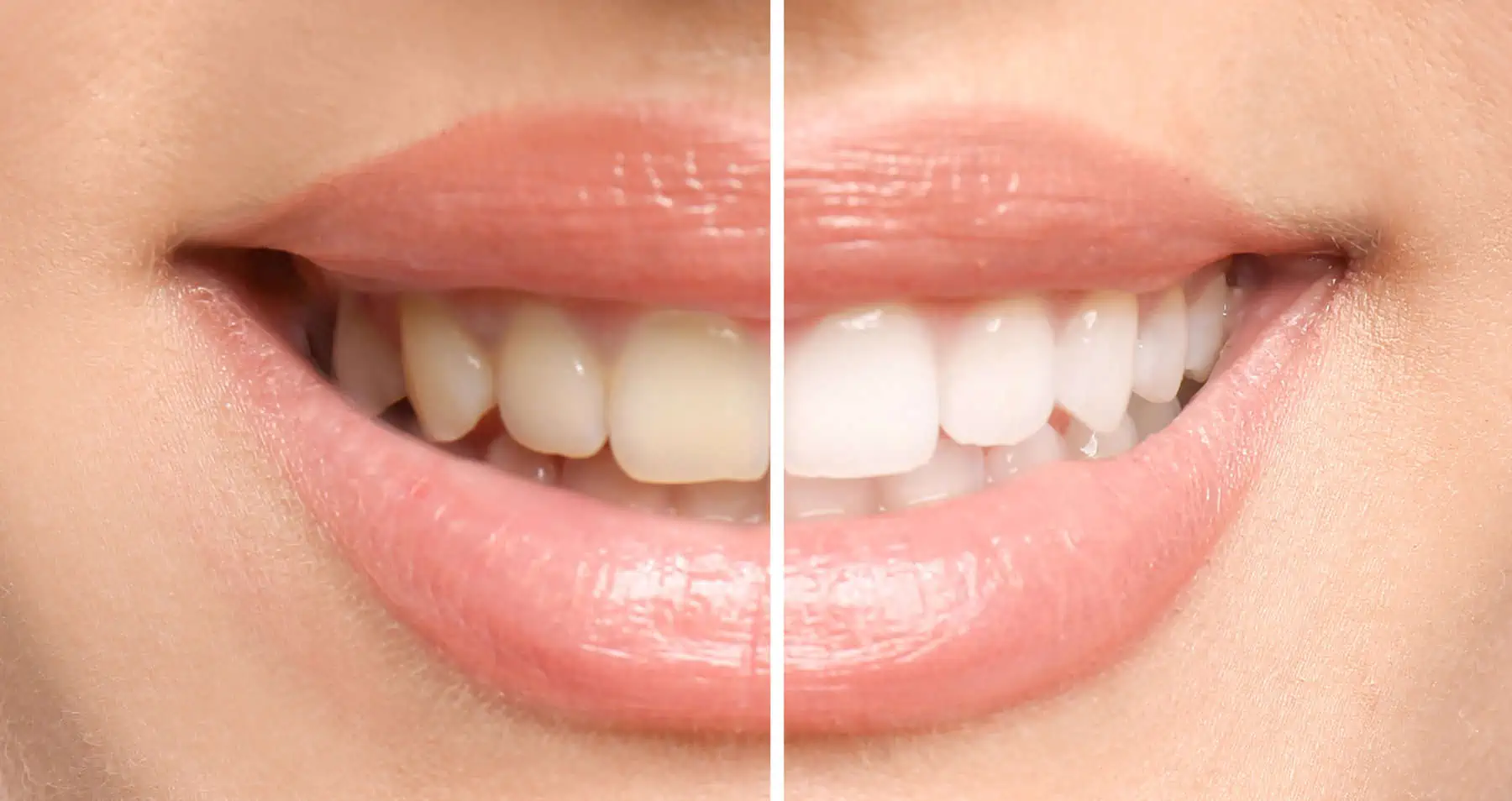 Precision Soft-Tissue