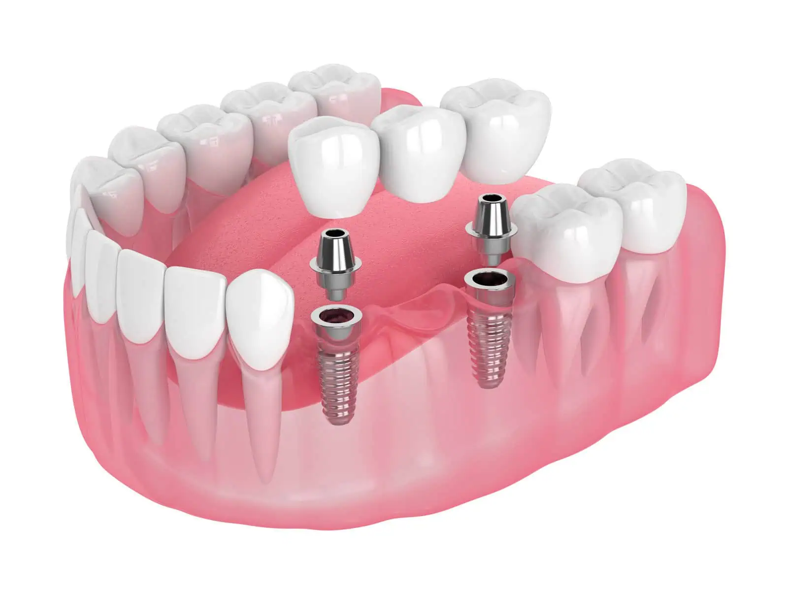 Gleem Dental Office Lakeview