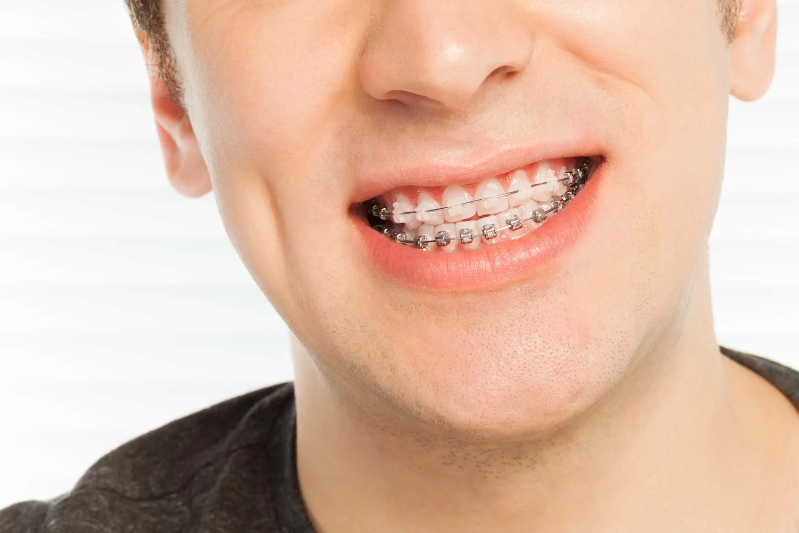 Gleem Dental Office Lakeview