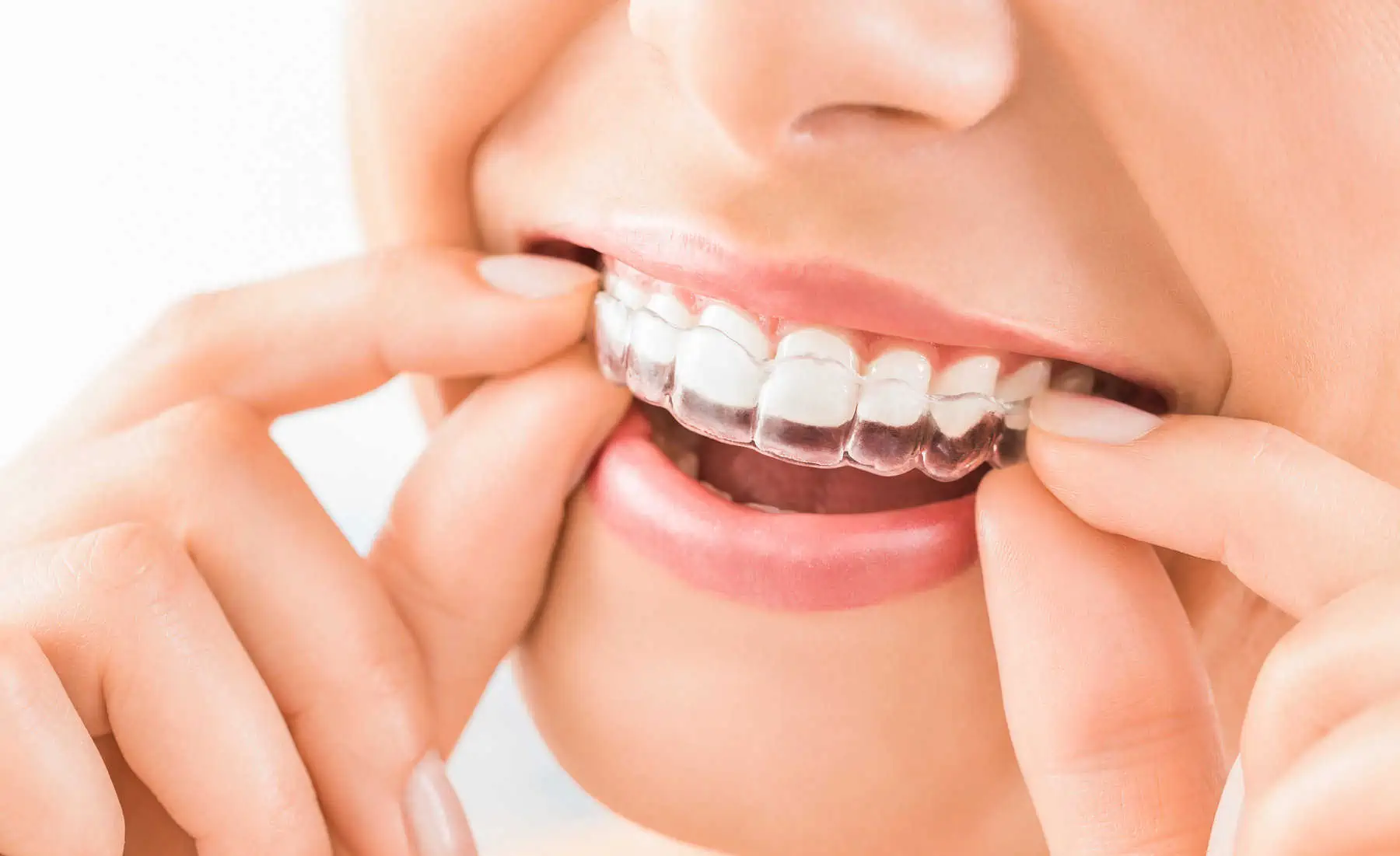 Gleem Dental Office Lakeview