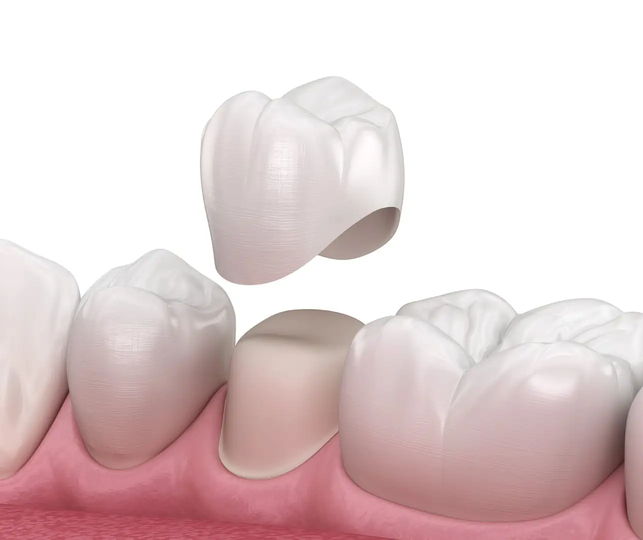 Gleem Dental Office Lakeview