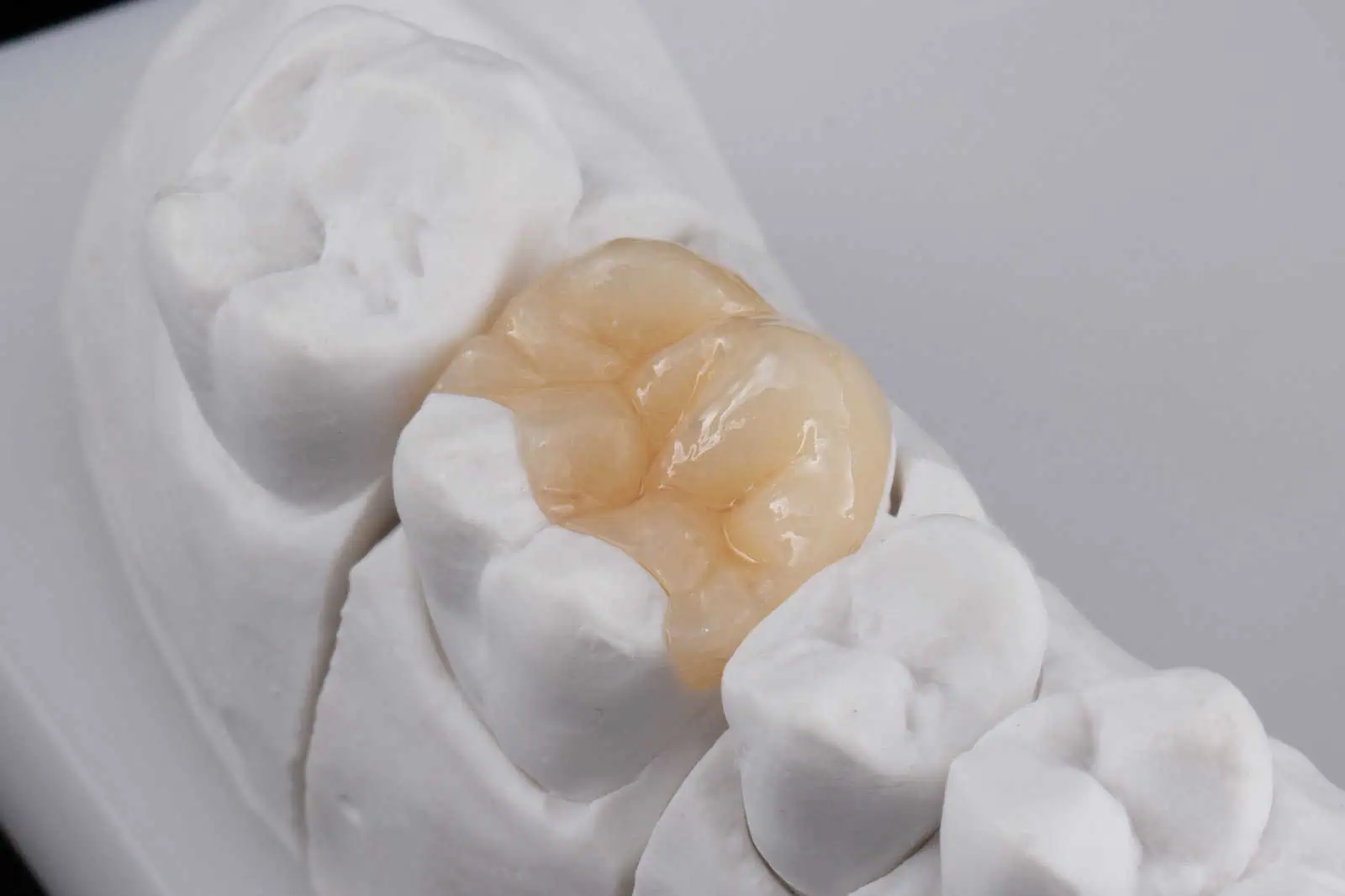 Gleem Dental Office Lakeview