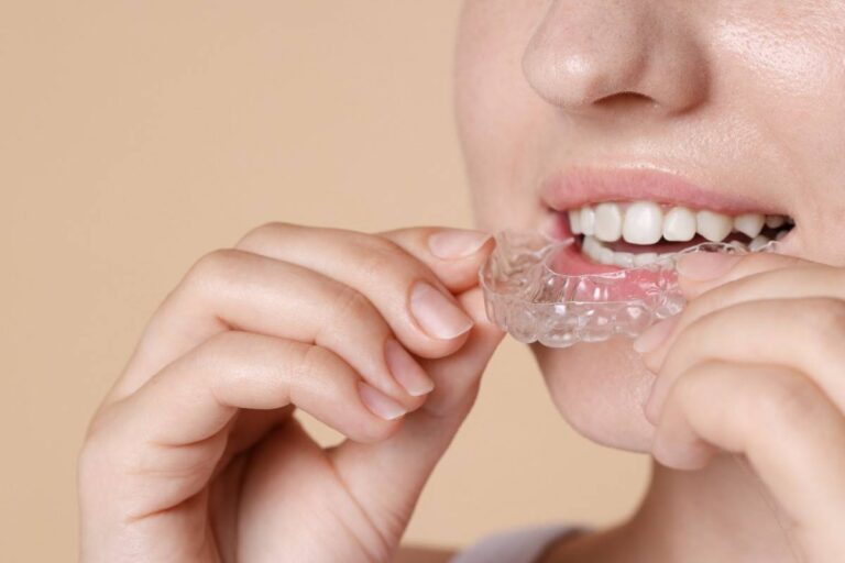 Wearing Invisalign Without Worries: Tips for Comfort
